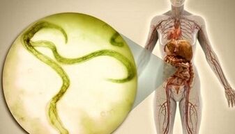 Come sbarazzarsi dei parassiti nel corpo