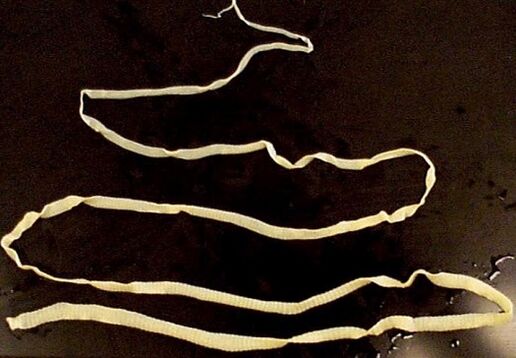 ampia tenia dal corpo umano