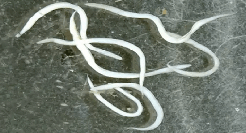 ossiuri nel corpo umano