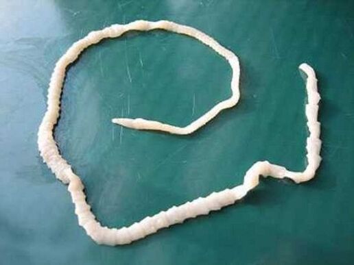 tenia di maiale umana