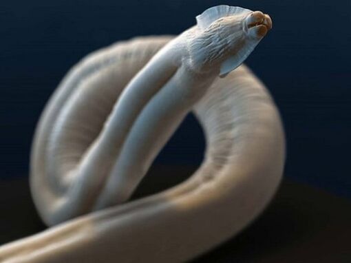 toxocara dal corpo umano