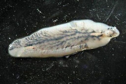 trematode epatico negli esseri umani