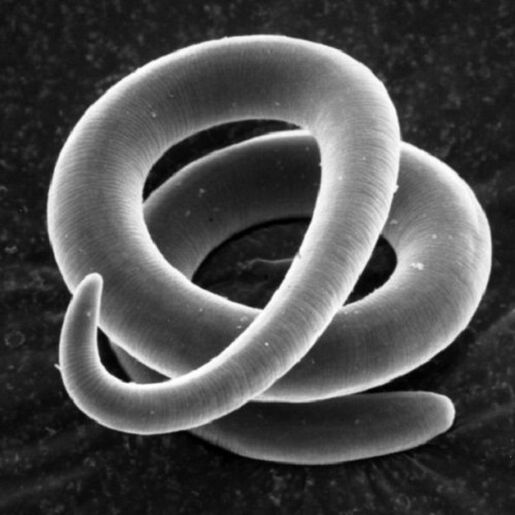 trichinella, parassita del verme, negli esseri umani