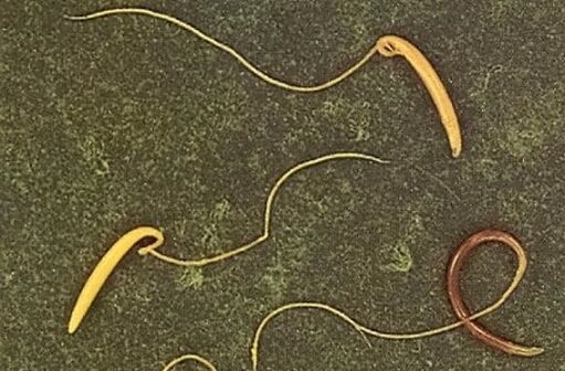 tricocefali dal corpo umano