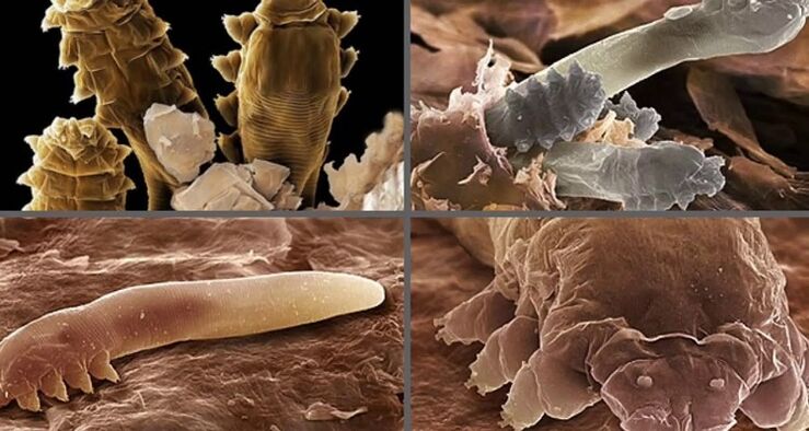 tipi di parassiti cutanei umani