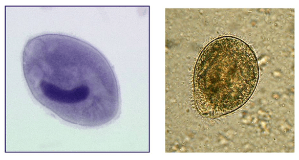 Balantidia ciliati, parassiti dell'intestino crasso
