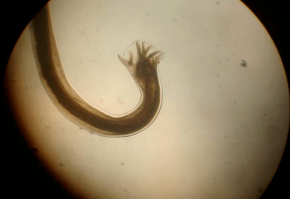 Parassita al microscopio